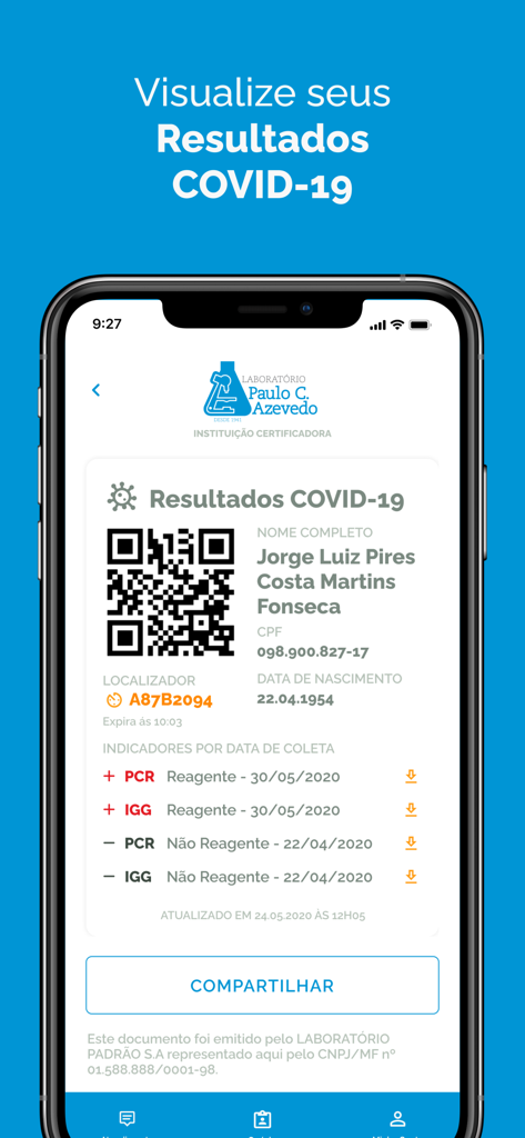 Laboratório - Paulo Azevedo - Pantalla de la aplicación móvil que muestra resultados digitales de pruebas COVID-19 con un código QR y un botón para compartir.