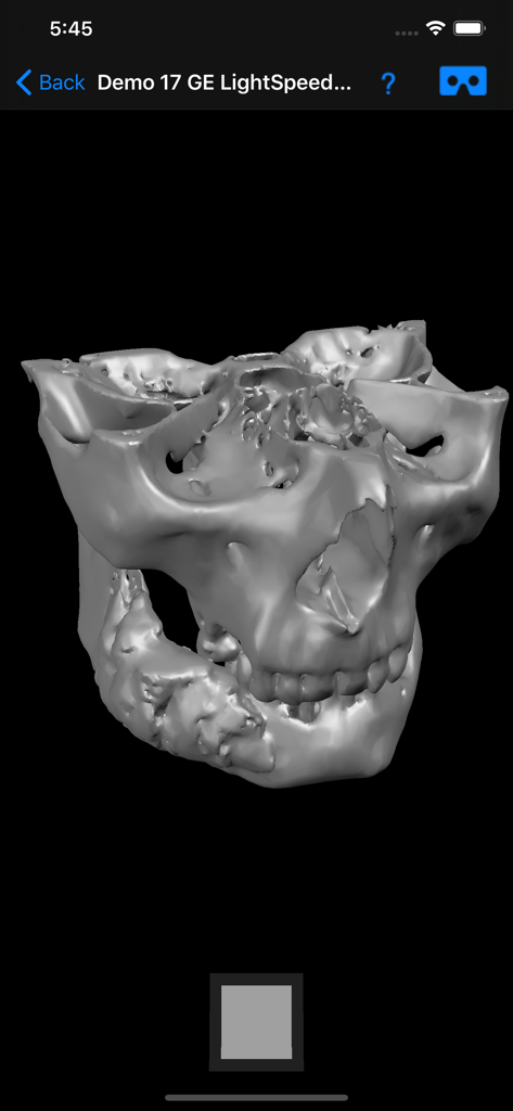 Dental CT View - 3D dental CT scan and jaw model on the Dental CT View app interface