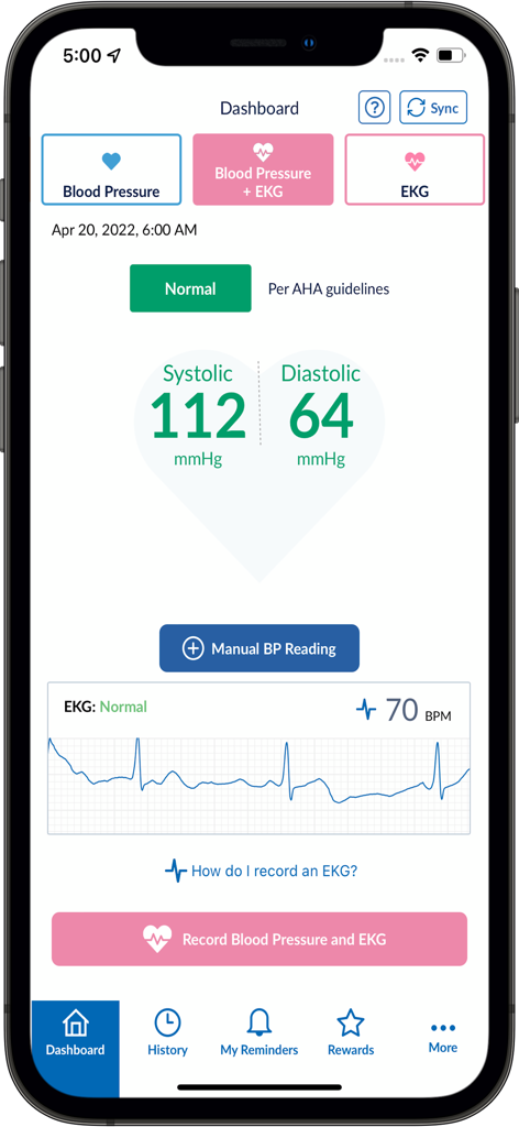 Omron Connect app dashboard showing normal blood pressure and EKG results