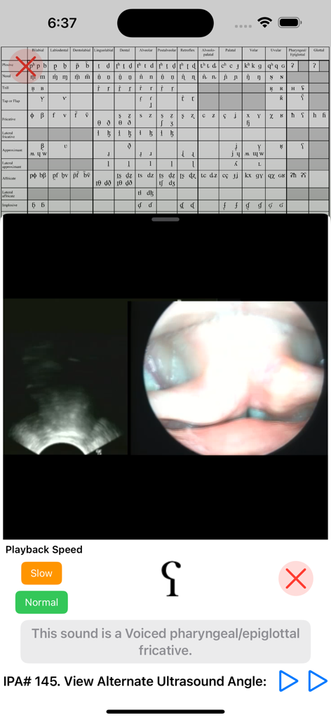 iPA Phonetics - Interface de l'application iPA Phonetics montrant côte à côte des vidéos d'échographie et de laryngoscopie d'un son fricatif pharyngé voisé.