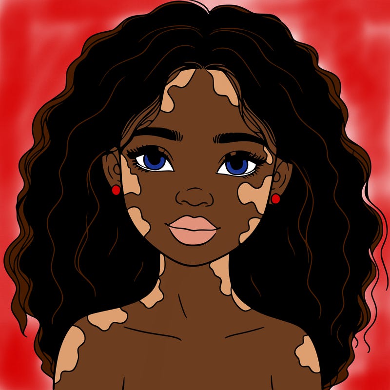 beautiful black girl with vitiligo