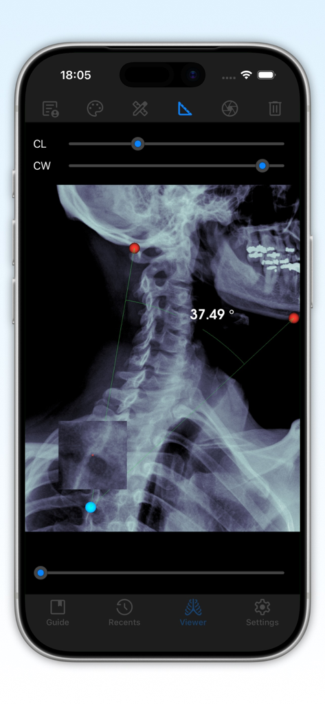 DICOM Studio Go - Cervical spine X-ray with an angle measurement tool displayed in the DICOM Studio Go mobile app on an iPhone