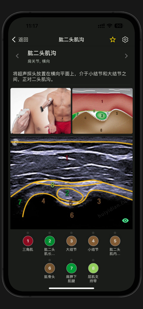 Medical ultrasound app tutorial showing bicipital groove probe placement and labeled anatomical imaging
