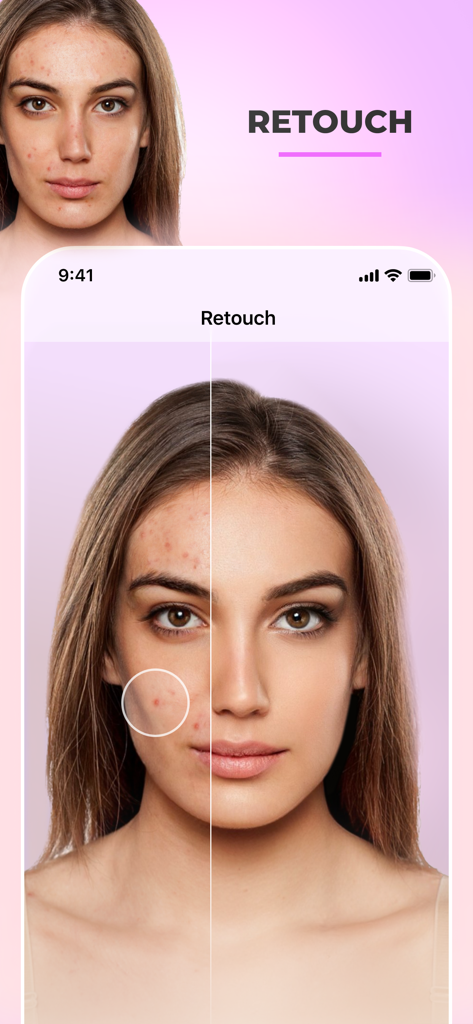 Before and after comparison of skin retouching and blemish removal in FaceApp