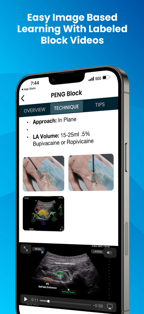 PNBschool Anesthesia Blocks | Master Ultrasound-Guided Nerve Blocks