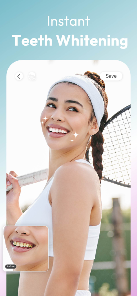 A before and after comparison of the instant teeth whitening feature in the YouCam Makeup app featuring a smiling woman.