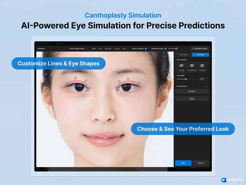 Anigma View - AI-powered eye surgery simulation interface on the Anigma View app for medical consultations