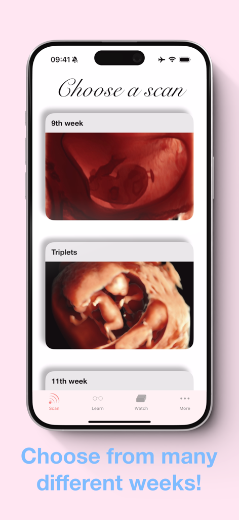 ScanBaby app screen showing options to choose ultrasound scans for different pregnancy weeks and triplets