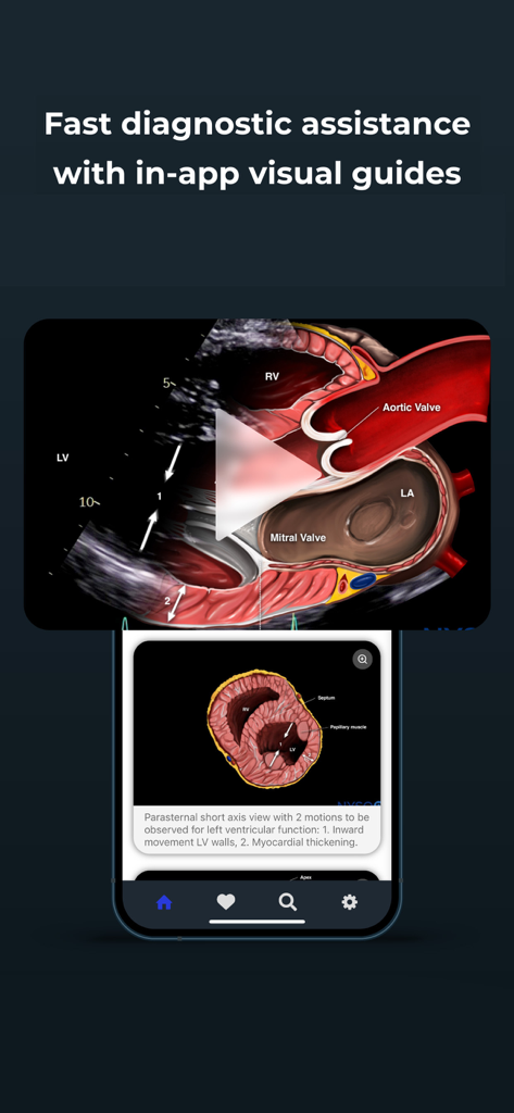 Point of Care Ultrasound - Interface do aplicativo NYSORA POCUS mostrando um guia visual de ultrassom cardíaco com rótulos anatômicos