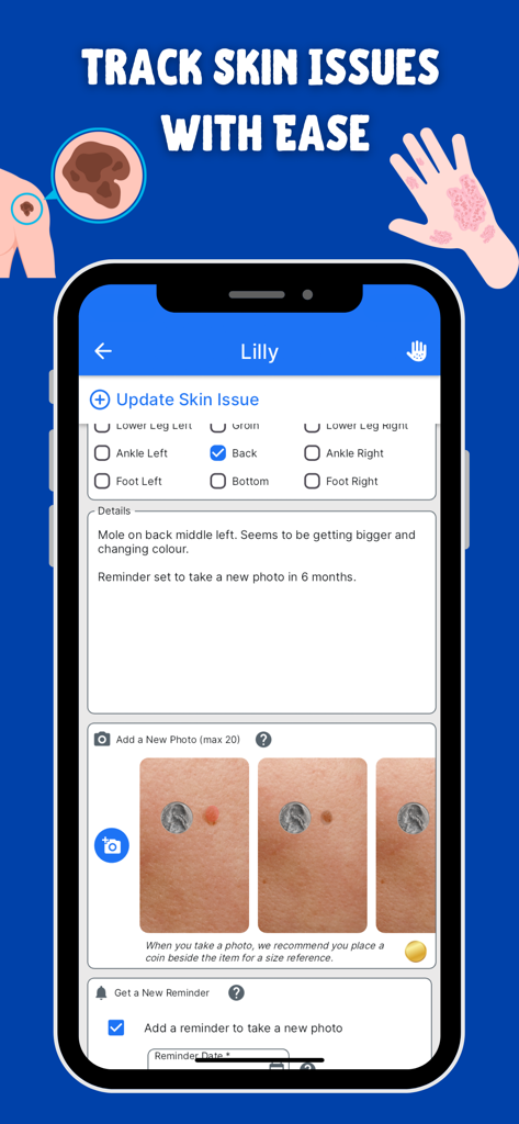 KeepTrackMed app interface for monitoring skin changes with photo logs and follow up reminders