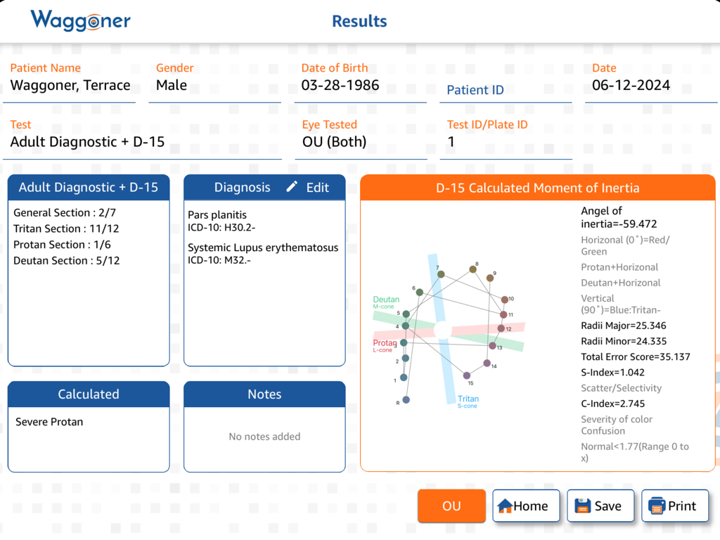 Waggoner CCVT - A clinical results dashboard from the Waggoner CCVT app showing adult diagnostic data and a D-15 calculated moment of inertia graph for color vision deficiency.