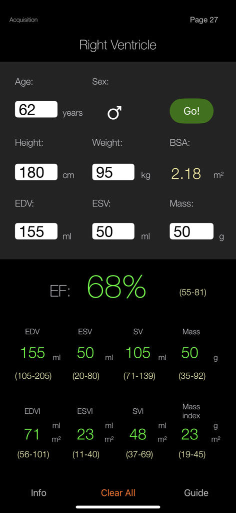 CMR Pocket Guide - CMRポケットガイドアプリのインターフェイス。右心室計算ツールが表示され、臨床測定値と正常範囲が含まれています。