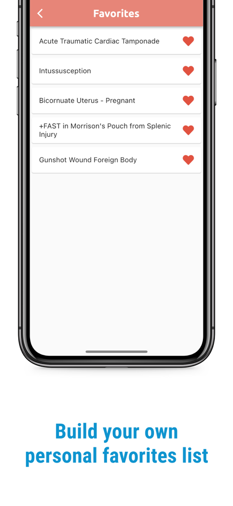 Screenshot of The POCUS Atlas app showing a personalized list of favorite ultrasound cases