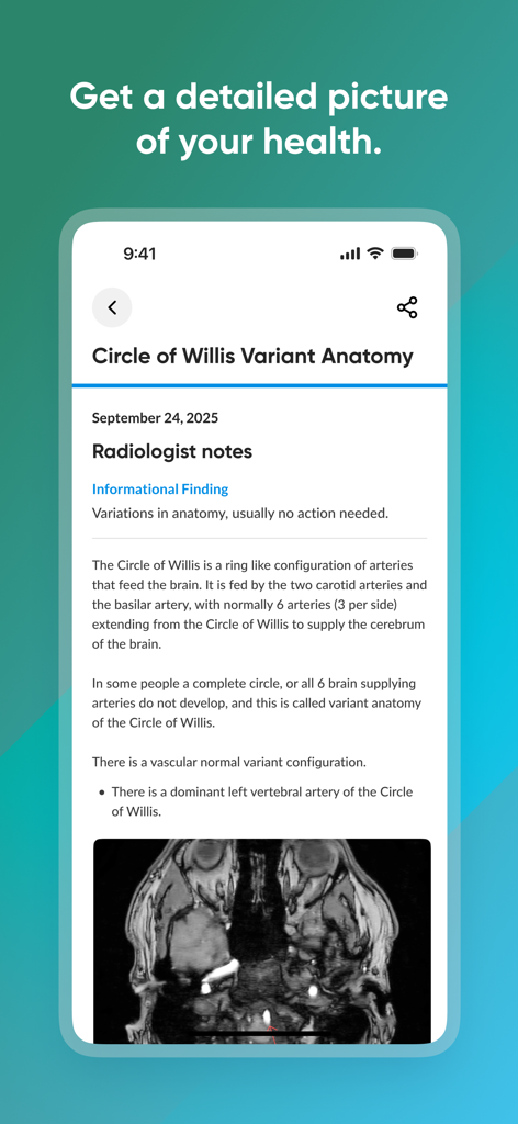 A detailed radiology report in the Prenuvo app showing Circle of Willis anatomy notes and an MRI scan image.