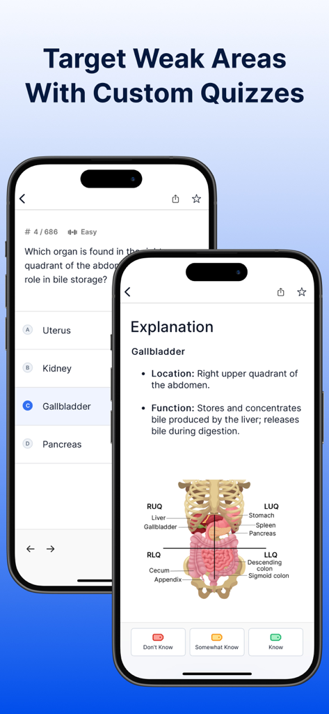 Surgical Technologist Mastery - L'application Maîtrise du Technicien en Chirurgie montrant un quiz d'entraînement et une explication anatomique de la vésicule biliaire