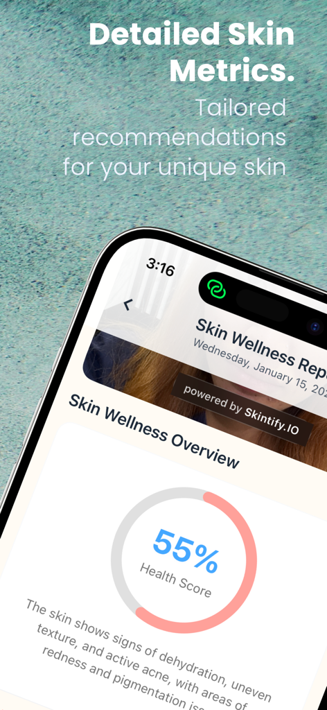 Skintify app interface showing a skin wellness report with a fifty-five percent health score and AI skin analysis details