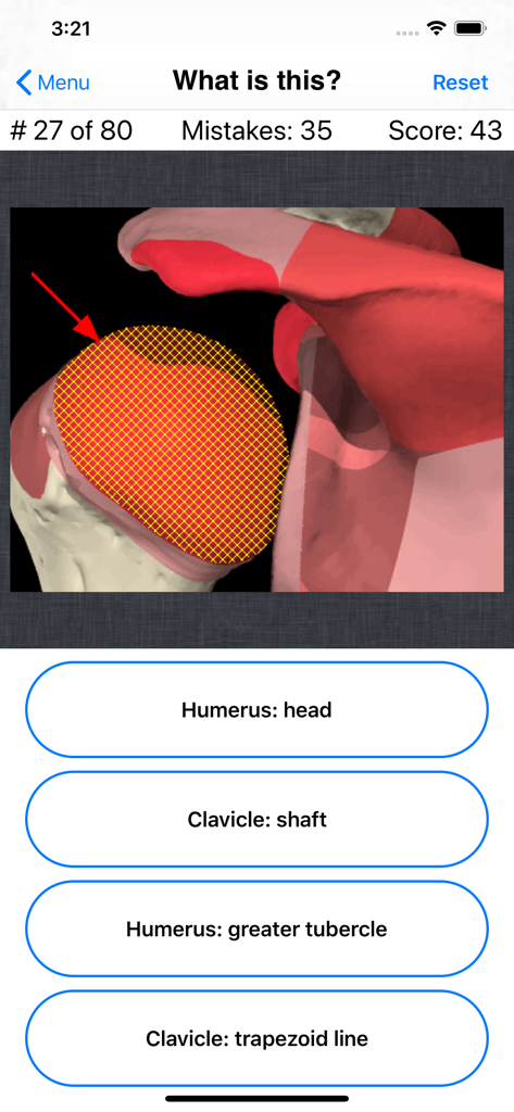 Anatomy Shoulder Quiz - Anatomy Shoulder Quiz interface showing a multiple choice question with a 3D diagram of the shoulder joint