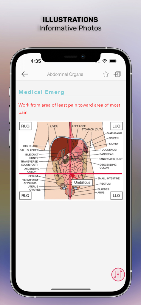 EMS Notes: EMT & Paramedic - Anatomical illustration of human abdominal organs and quadrants in the EMS Notes app.