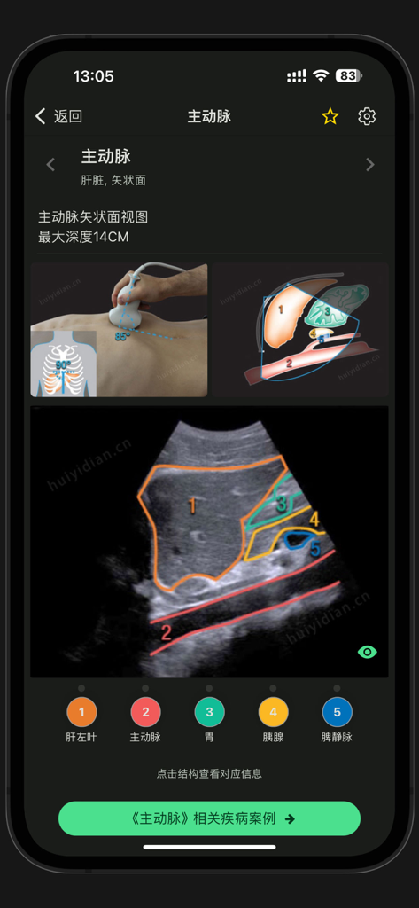 Ultrasound Smart Learning app screen displaying an abdominal aorta scan with anatomical diagrams and numbered labels for medical training.