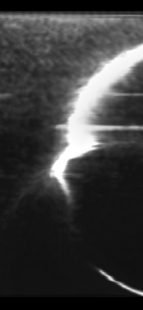 DeadWave - Monochrome abstract visual ITC feedback pattern used for paranormal research in the DeadWave app