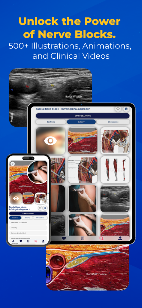 NYSORA Nerve Blocks app interface showing a gallery of anatomical illustrations and ultrasound images