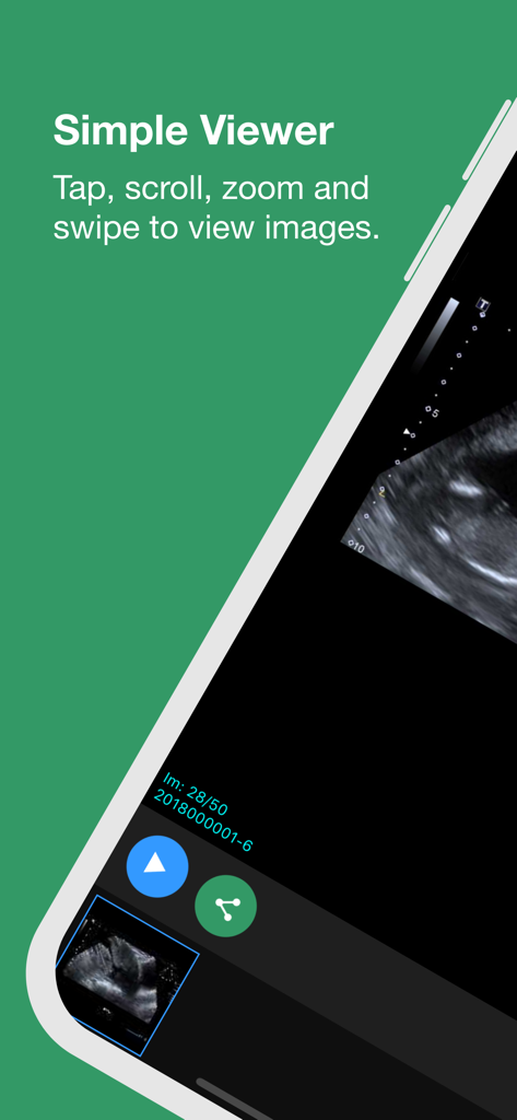 CIG Patient Results - A mobile screen showing the medical image viewer of the CIG Patient Results app with ultrasound results