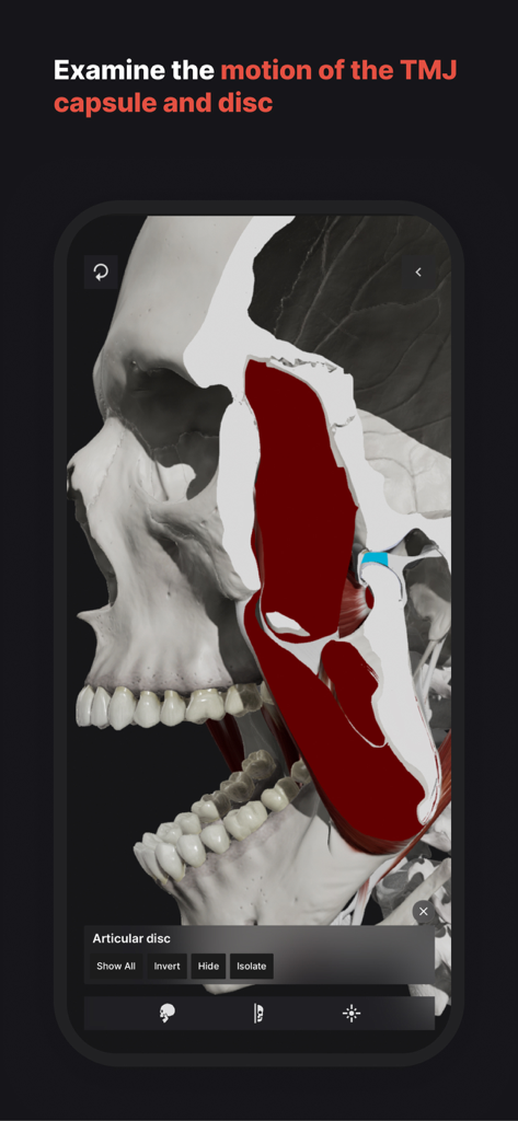 3D-anatomischer Querschnitt des menschlichen Schädels und Kiefers, der die Kiefergelenkscheibe hervorhebt