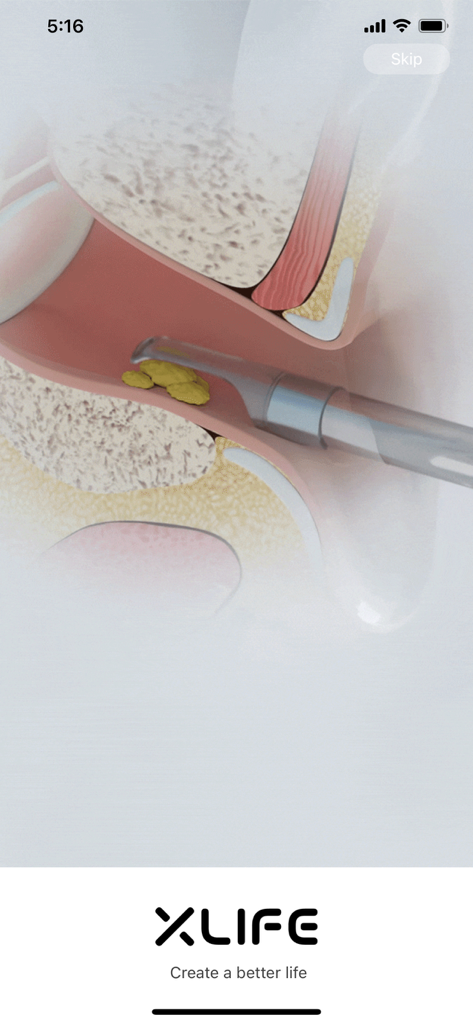 Xlife - Xlifeアプリの起動画面内で耳垢を掃除する耳鏡の図