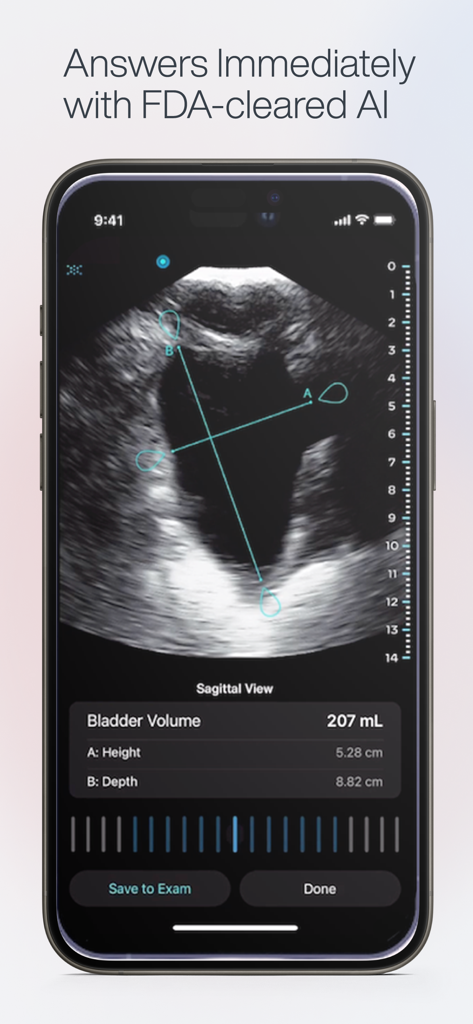 Exo Iris™ - Exo Iris app showing a sagittal view ultrasound scan of a bladder with AI volume measurements