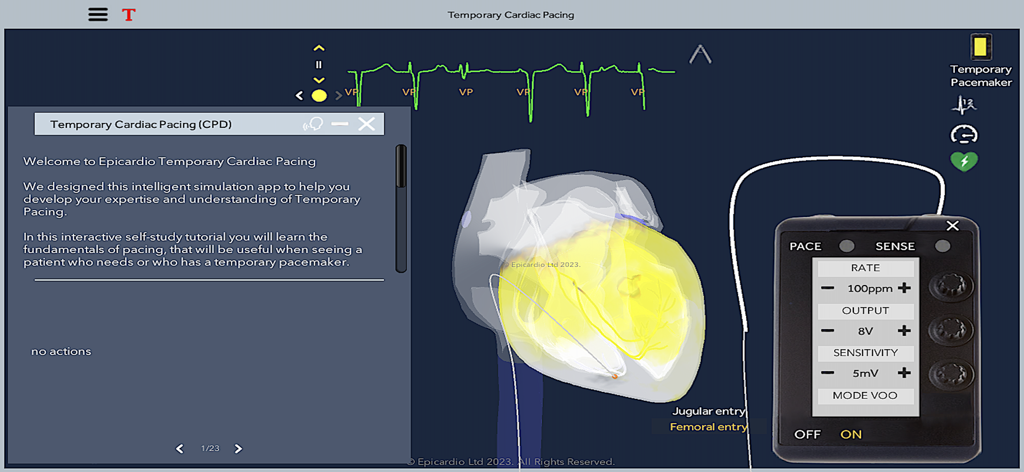 Interface of the Temporary Cardiac Pacing app showing a 3D heart model, ECG trace, and pacemaker controls.