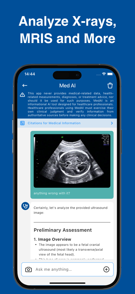 Med AI Doctor Assistant - スマートフォンで胎児超音波画像のAI駆動分析を示すMed AIアプリのインターフェース。