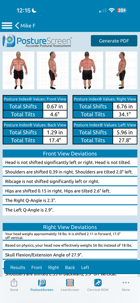 Clinical posture assessment report in PostureScreen Mobile showing four view body scans and detailed postural deviation data