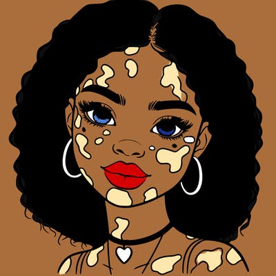 bleautiful black girl with vitiligo