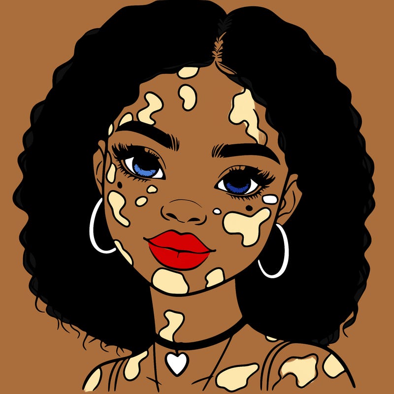 bleautiful black girl with vitiligo