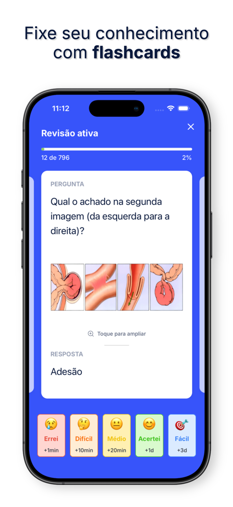 Interface of the MEDsimple app showing a medical flashcard with anatomical diagrams and active recall study options.