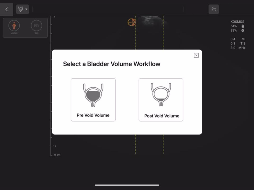 Kosmos Ultrasound 4.0 - Kosmos Ultrasound app interface showing bladder volume workflow selection with pre void and post void options