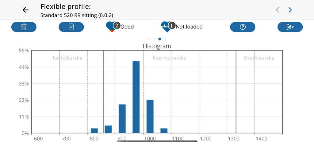 HRV-Analysis - Un histogramme dans l'application HRV-Analysis montrant la distribution des intervalles de battements cardiaques et des zones cardiaques.
