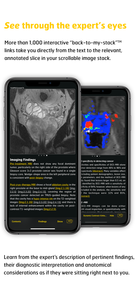 MR Imaging in Prostate Cancer - App interface showing prostate MRI scans with expert diagnostic findings and interactive links