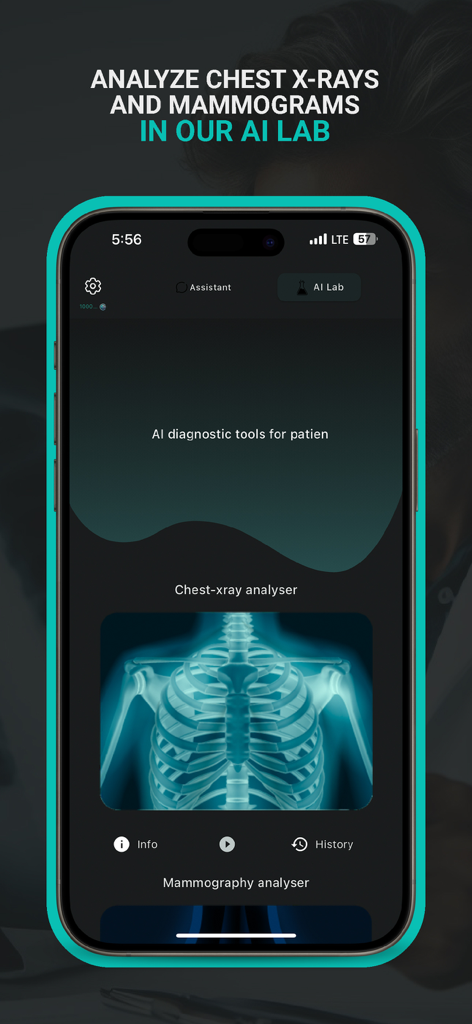 Interface of the DoctorAI mobile app showing the chest x-ray analyzer tool within the AI Lab section