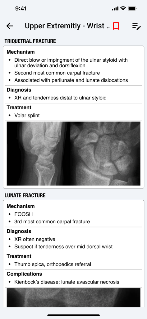 palmEM AI: EM Quick Reference - Clinical reference for wrist fractures with X-ray images and treatment guidelines in palmEM AI