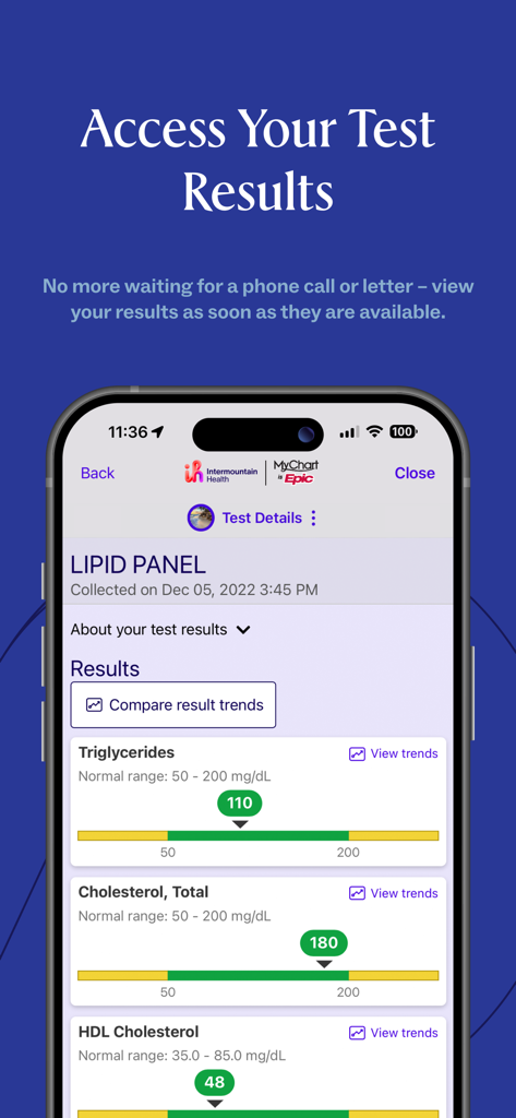 Intermountain Health app displaying lipid panel lab results with visual trend indicators on a mobile screen