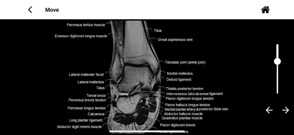 Detailed MRI scan of the ankle and foot with anatomical labels in the MRI MASTER app