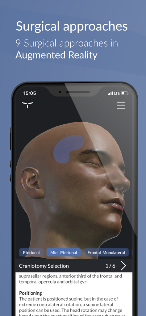 UpSurgeOn Neurosurgery - Augmented reality 3D visualization of surgical approaches on a human head within the UpSurgeOn app