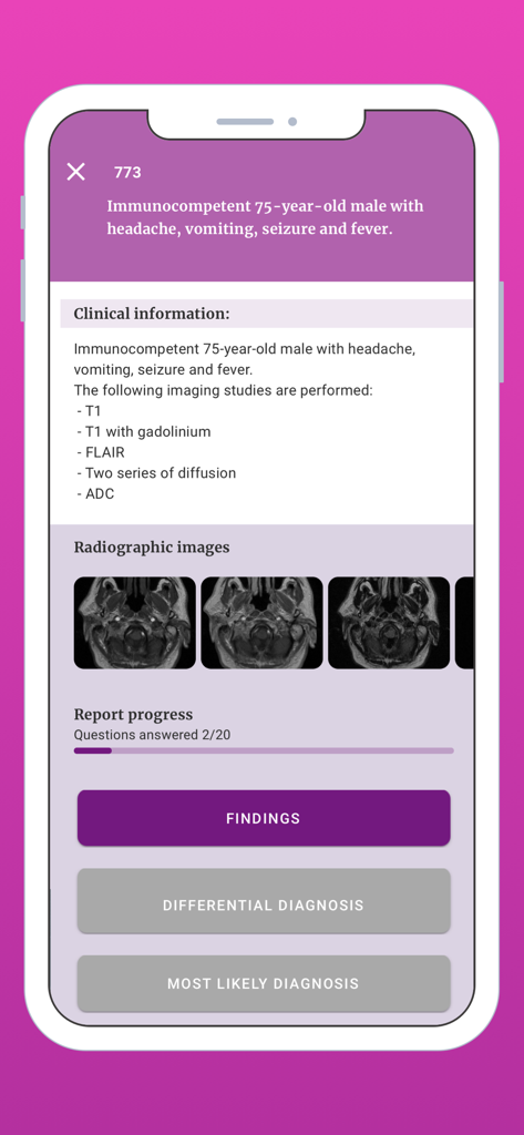 EDiR App - Interfaz de la aplicación EDiR que muestra un estudio de caso de radiología con historial del paciente y escáneres cerebrales