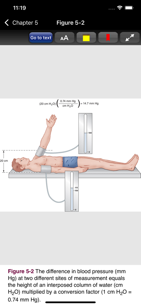 Clinical Anesthesiology, 7/E - Diagram showing blood pressure differences at two different measurement sites in the Clinical Anesthesiology app