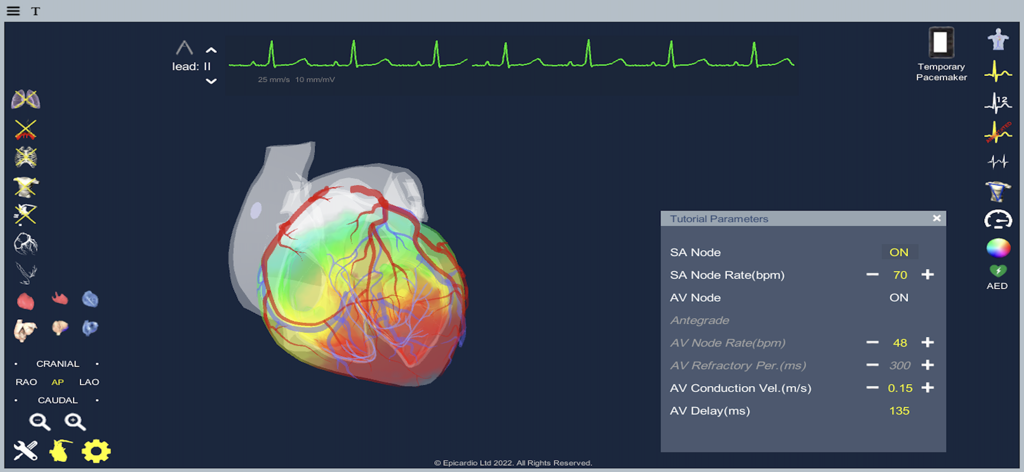 Interactive 3D heart anatomy and ECG rhythm simulation interface