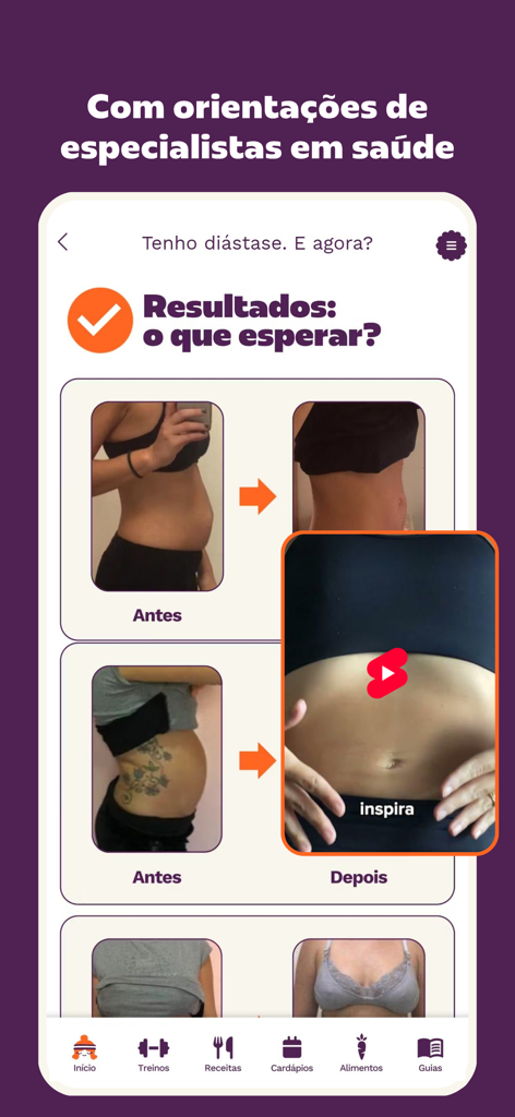 Superela: Exercícios, Receitas - Superela app interface displaying before and after photos for diastasis recti recovery results.