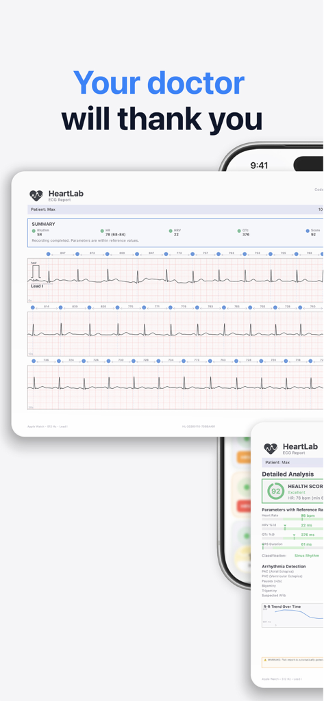 Professional ECG report with heart rate and cardiac metrics for doctors