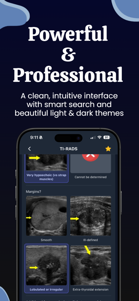 Radiology Calculators app interface showing TI-RADS ultrasound diagnostic criteria with image examples in dark mode theme.