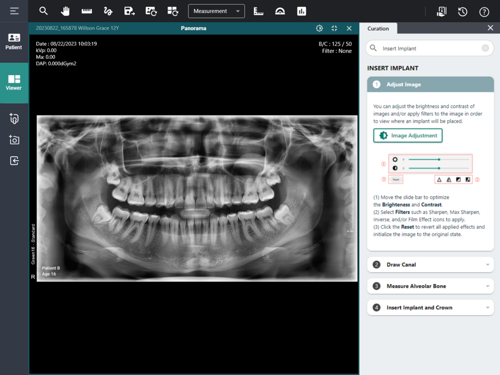 La interfaz de imágenes dentales de EzDent Web que muestra un escaneo panorámico y herramientas de implantes.